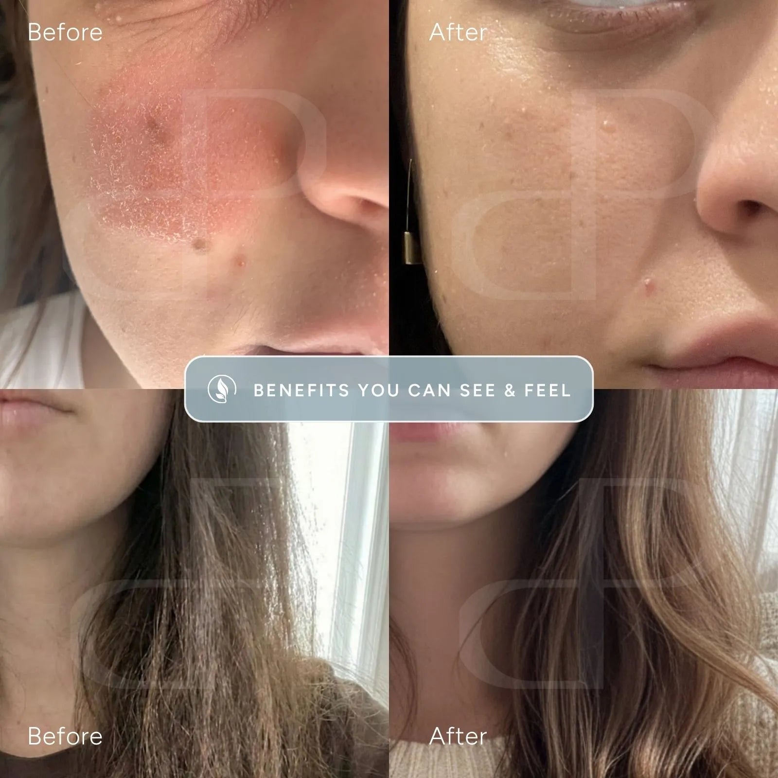 Before and after hair and skin comparison, clearer Skin After Switching to Filtered Water, showing a cheek with red, dry, and bumpy skin on the left, and smoother, calmer skin on the right, and  and showing hair dry and brittle on the left and smoother, softer hair on the left.