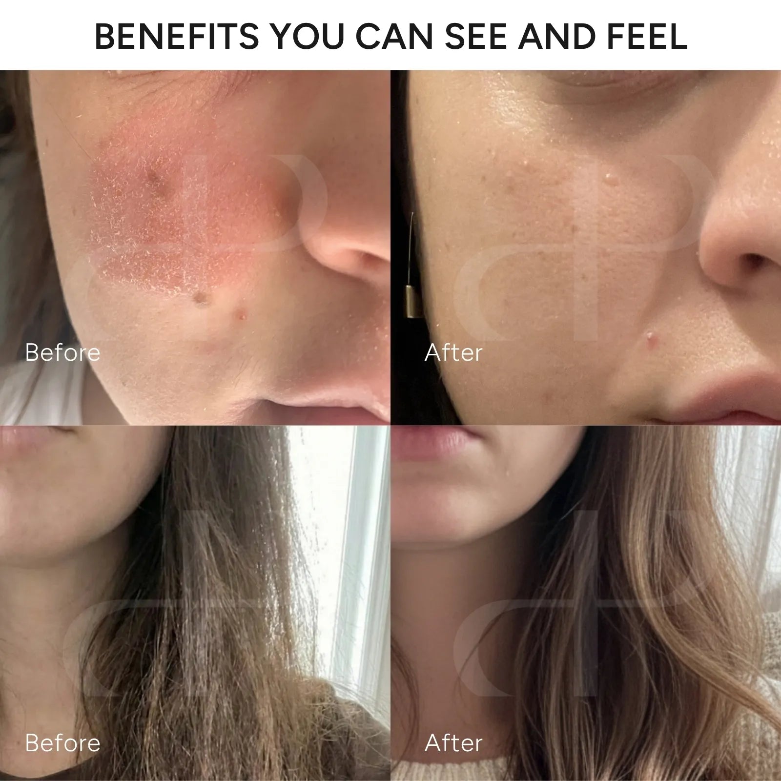 Before and after hair and skin comparison, clearer Skin After Switching to Filtered Water, showing a cheek with red, dry, and bumpy skin on the left, and smoother, calmer skin on the right, and  and showing hair dry and brittle on the left and smoother, softer hair on the left.